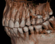 CT(2)