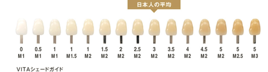 VITAシェードガイド