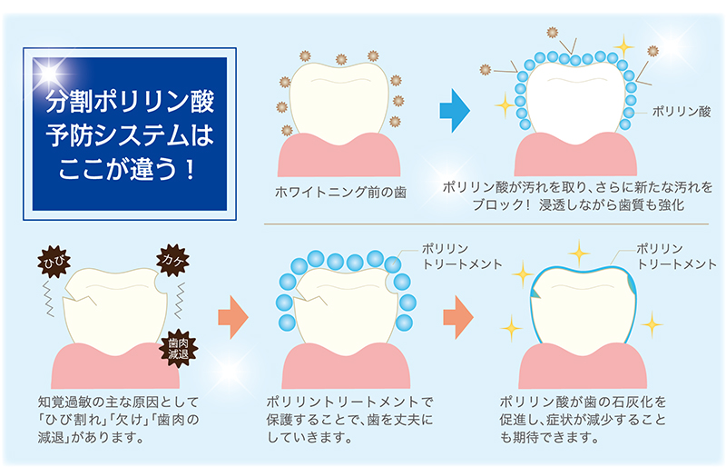 ホワイトニング